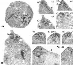 Attēlu rezultāti vaicājumam “Arcyria cinerea young”