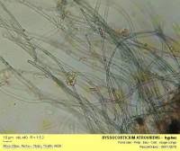 Attēlu rezultāti vaicājumam “Byssocorticium atrovirens”