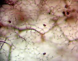 Attēlu rezultāti vaicājumam “Stemonitis marjana stalked”