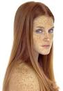 What are freckles ? | Freckles On Lips