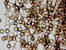 Attēlu rezultāti vaicājumam “Stemonitis splendens spores”