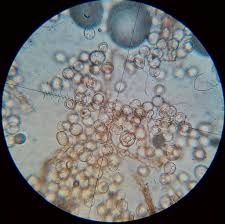 Attēlu rezultāti vaicājumam “Arcyria affinis”