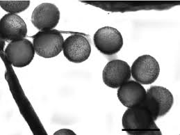 Attēlu rezultāti vaicājumam “Oligonema flavidum spores”