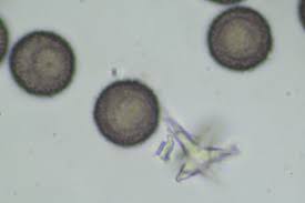 Attēlu rezultāti vaicājumam “Didymium squamulosum spores”