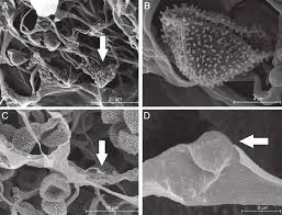 Attēlu rezultāti vaicājumam “Physarum decipiens spores”