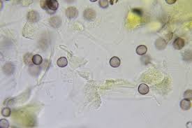 Attēlu rezultāti vaicājumam “Physarum daamsii sessile”