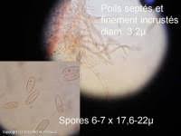 Attēlu rezultāti vaicājumam “Lachnellula willkommii”