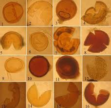 Attēlu rezultāti vaicājumam “Ombrophila violacea spores”