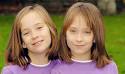 Siamese-twins-5_blog.jpg