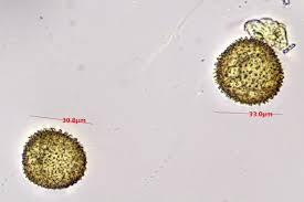 Attēlu rezultāti vaicājumam “Physarum orbis stalked”