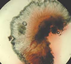 Attēlu rezultāti vaicājumam “Mycoblastus sanguinarius”