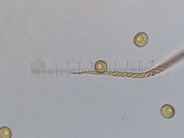 Attēlu rezultāti vaicājumam “Metatrichia floriformis macro”