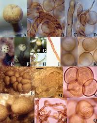 Attēlu rezultāti vaicājumam “Hemitrichia leiotricha stalked”