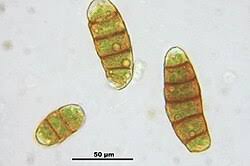 Attēlu rezultāti vaicājumam “Orthotrichum, Nyholmiella”