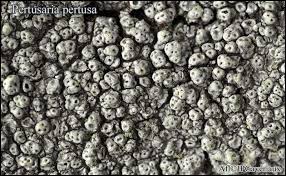 Attēlu rezultāti vaicājumam “Pertusaria pertusa”