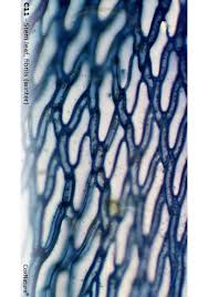 Attēlu rezultāti vaicājumam “Sphagnum angustifolium sporophyte”