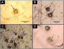 Attēlu rezultāti vaicājumam “Diachea dictyospora (syn. Craterium dictyosporum) spores”