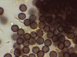 Attēlu rezultāti vaicājumam “Didymium xanthopus spores”