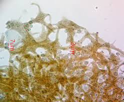 Attēlu rezultāti vaicājumam “Cribraria costata”
