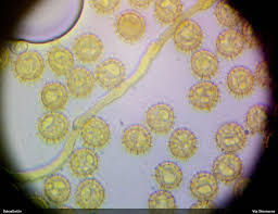 Attēlu rezultāti vaicājumam “Oligonema flavidum”