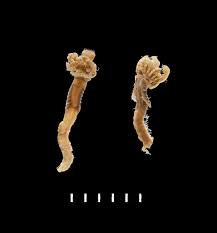 Attēlu rezultāti vaicājumam “Amaurochaete fusiformis”