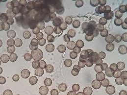 Attēlu rezultāti vaicājumam “Physarum virescens spores”