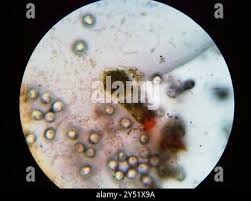 Attēlu rezultāti vaicājumam “Physarum psittacinum spores”