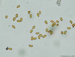 Attēlu rezultāti vaicājumam “Didymium serpula spores”