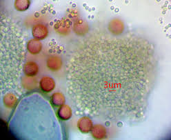 Attēlu rezultāti vaicājumam “Lycogala ustulatum macro”