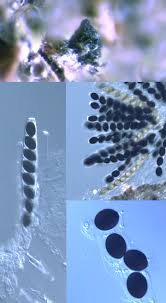 Attēlu rezultāti vaicājumam “Sordaria fimicola”