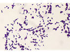 Listeria monocytogenes