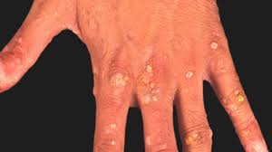 Image result for Lewandowsky-Lutz