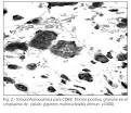 actina y <b>osteonectina</b>)