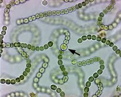 Attēlu rezultāti vaicājumam “Nostoc pruniforme cells”