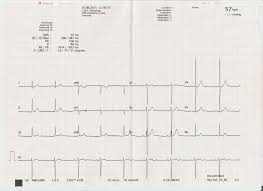 Image result for  ^ L V [ h    