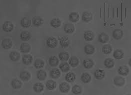 Attēlu rezultāti vaicājumam “Lycogala cf. oleocrystalliferum young”