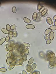 Attēlu rezultāti vaicājumam “Arcyria globosa”