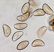 Attēlu rezultāti vaicājumam “Barbeyella minutissima spores”