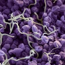 Attēlu rezultāti vaicājumam “Diachea leucopodia spores”