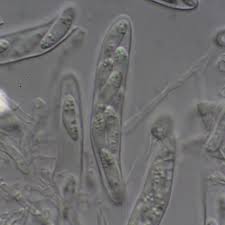 Attēlu rezultāti vaicājumam “Hyaloscypha hyalina”