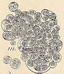 Attēlu rezultāti vaicājumam “Gloeocapsa rupestris”