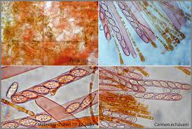 Attēlu rezultāti vaicājumam “Melastiza chateri”