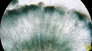 Attēlu rezultāti vaicājumam “Scoliciosporum chlorococcum”