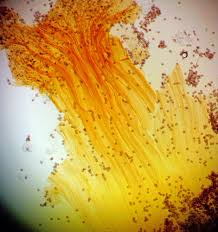 Attēlu rezultāti vaicājumam “Didymium megalosporum”