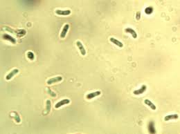 Attēlu rezultāti vaicājumam “Phlebia tremellosa”