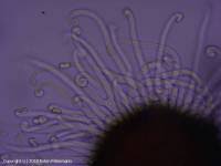 Attēlu rezultāti vaicājumam “Sawadaea tulasnei”