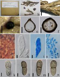 Attēlu rezultāti vaicājumam “Cystocoleus ebeneus”