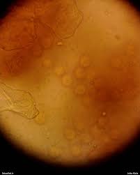 Attēlu rezultāti vaicājumam “Lycogala ustulatum macro”