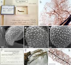 Attēlu rezultāti vaicājumam “Stemonitis fusca spores”