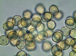 Attēlu rezultāti vaicājumam “Trichia contorta”